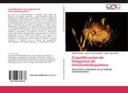 Cover von Cuantificación de Imágenes de Inmunohistoquímica