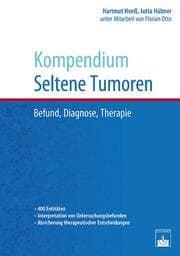 Cover von Kompendium Seltene Tumoren