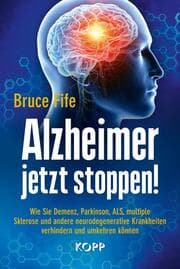 Cover von Alzheimer jetzt stoppen!