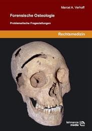 Cover von Forensische Osteologie