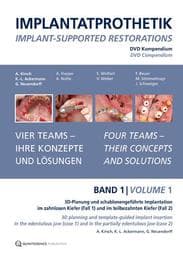 Cover von Implantatprothetik. DVD, Band 1