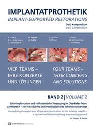 Cover von Implantatprothetik. DVD, Band 2