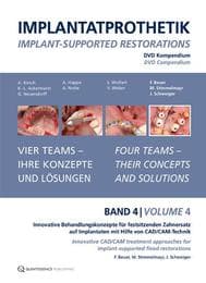 Cover von Implantatprothetik. DVD, Band 4