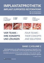 Cover von Implantatprothetik. Blu-Ray, Band 2