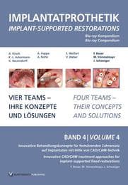 Cover von Implantatprothetik. Blu-Ray, Band 4