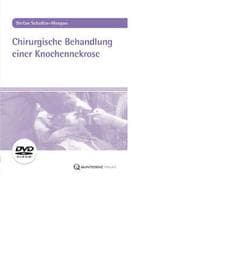 Cover von Chirurgische Behandlung einer Knochennekrose