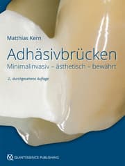 Cover von Adhäsivbrücken