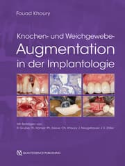 Cover von Knochen- und Weichgewebeaugmentation in der Implantologie
