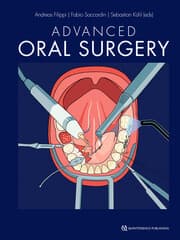 Cover von Advanced Oral Surgery