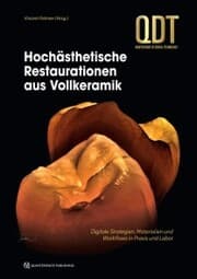Cover von Hochästhetische Restaurationen aus Vollkeramik