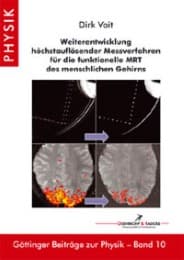 Cover von Weiterentwicklung höchstauflösender Messverfahren für die funktionelle MRT des menschlichen Gehirns
