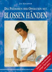 Cover von Das Phänomen der Operation mit blossen Händen