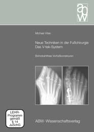 Cover von Neue Techniken in der Fußchirurgie - Das V-tek-System