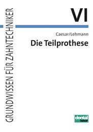 Cover von Die Teilprothese