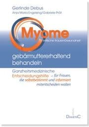Cover von Myome gebärmuttererhaltend behandeln