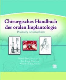 Cover von Chirurgisches Handbuch der oralen Implantologie