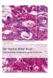 Cover von Der Feind in deiner Brust. Früherkennung und Behandlung von Brustkrebs