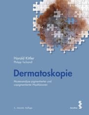Cover von Dermatoskopie