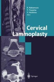 Cover von Cervical Laminoplasty