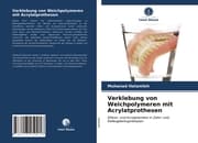 Cover von Verklebung von Weichpolymeren mit Acrylatprothesen