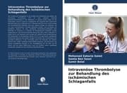Cover von Intravenöse Thrombolyse zur Behandlung des ischämischen Schlaganfalls