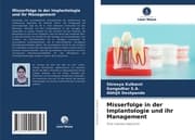 Cover von Misserfolge in der Implantologie und ihr Management