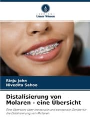 Cover von Distalisierung von Molaren - eine Übersicht