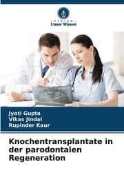 Cover von Knochentransplantate in der parodontalen Regeneration