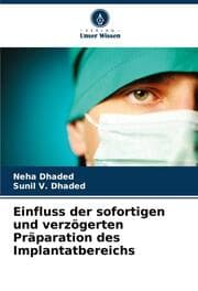 Cover von Einfluss der sofortigen und verzögerten Präparation des Implantatbereichs