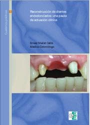 Cover von Reconstrucción de dientes endodonciados