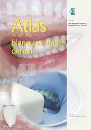 Cover von Atlas terapéutico de blanqueamiento dental