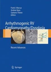 Cover von Arrhythmogenic RV Cardiomyopathy/Dysplasia