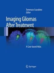 Cover von Imaging Gliomas After Treatment