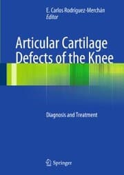 Cover von Articular Cartilage Defects of the Knee