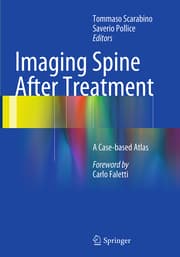 Cover von Imaging Spine After Treatment