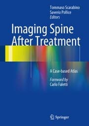 Cover von Imaging Spine After Treatment