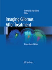 Cover von Imaging Gliomas After Treatment