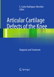 Cover von Articular Cartilage Defects of the Knee