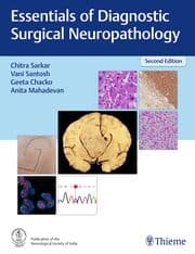 Cover von Essentials of Diagnostic Surgical Neuropathology