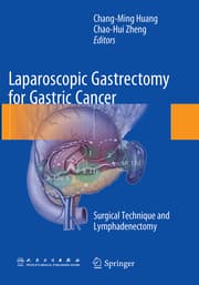 Cover von Laparoscopic Gastrectomy for Gastric Cancer