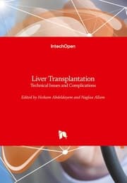 Cover von Liver Transplantation