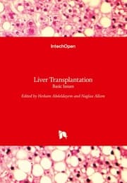 Cover von Liver Transplantation