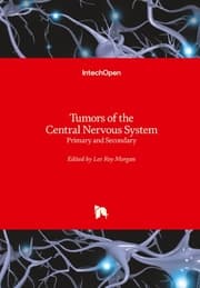 Cover von Tumors of the Central Nervous System