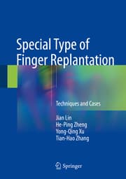 Cover von Special Type of Finger Replantation