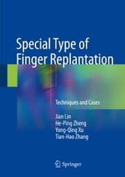 Cover von Special Type of Finger Replantation