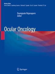Cover von Ocular Oncology