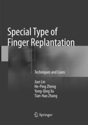 Cover von Special Type of Finger Replantation