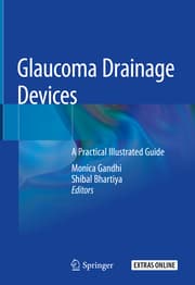 Cover von Glaucoma Drainage Devices