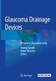 Cover von Glaucoma Drainage Devices