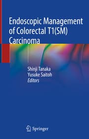 Cover von Endoscopic Management of Colorectal T1(SM) Carcinoma